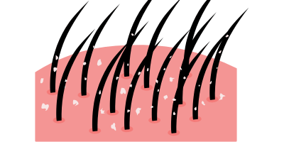 hair damage